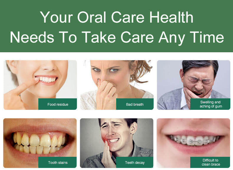 Rechargeable Water Flosser Full Oral Teeth Cleaner - Buyrouth